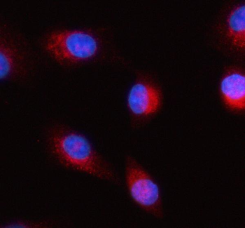 HERP/HERPUD1 Antibody