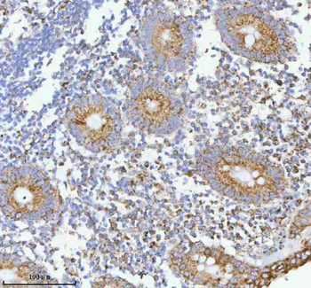 HERP/HERPUD1 Antibody