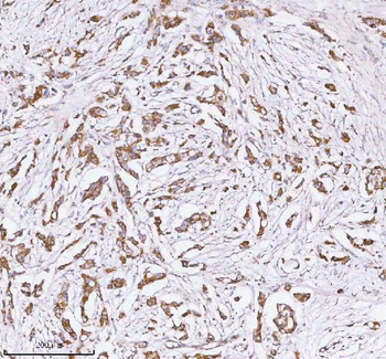 HERP/HERPUD1 Antibody