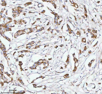 HERP/HERPUD1 Antibody