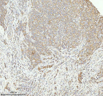 HERP/HERPUD1 Antibody