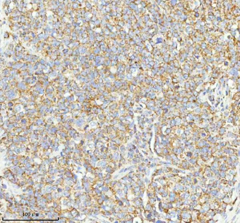 HERP/HERPUD1 Antibody