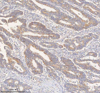 ERBB4 Rabbit Polyclonal Antibody