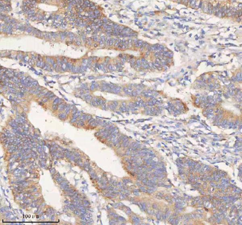 ERBB4 Rabbit Polyclonal Antibody