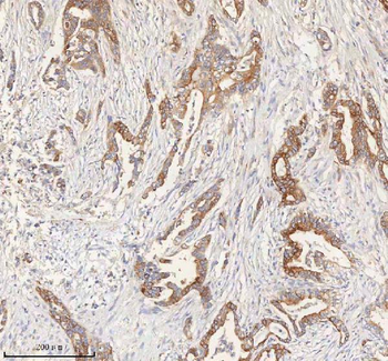 ERBB4 Rabbit Polyclonal Antibody