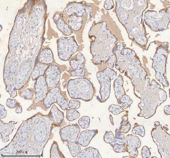 ERBB4 Rabbit Polyclonal Antibody