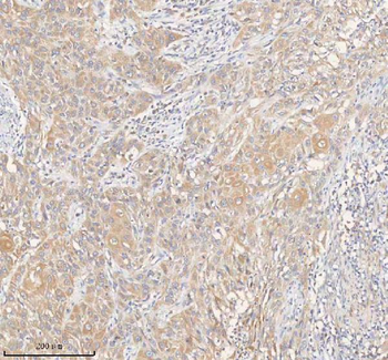 ERBB4 Rabbit Polyclonal Antibody