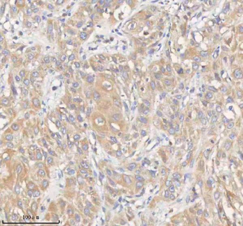 ERBB4 Rabbit Polyclonal Antibody