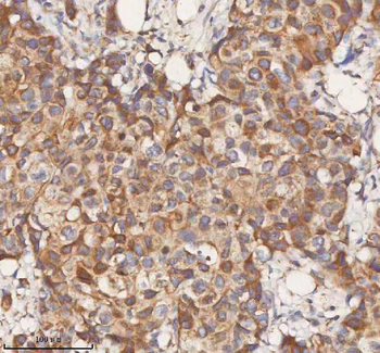 STIM1 Antibody