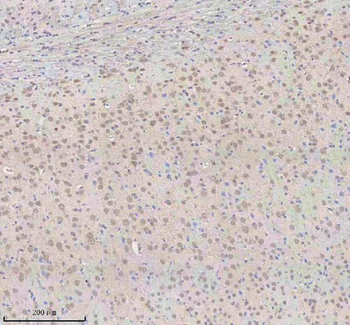 SNRNP70 Rabbit Polyclonal Antibody