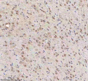 SNRNP70 Rabbit Polyclonal Antibody