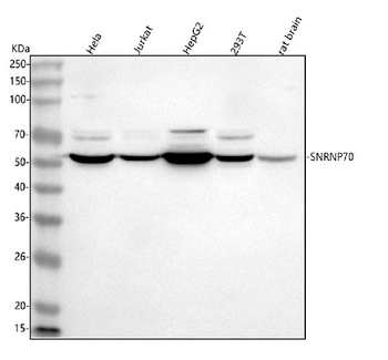 SNRNP70 Rabbit Polyclonal Antibody