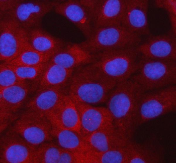 SMTNL2 Rabbit Polyclonal Antibody