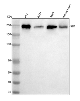 SLK Rabbit Polyclonal Antibody