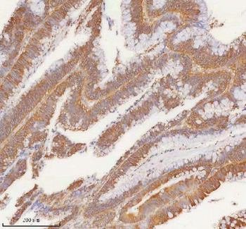 SLK Rabbit Polyclonal Antibody