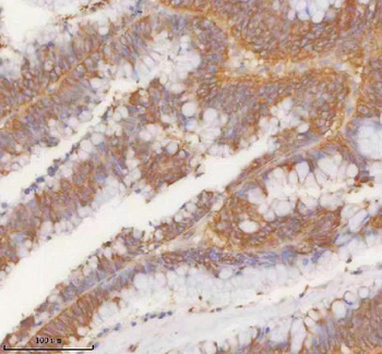 SLK Rabbit Polyclonal Antibody