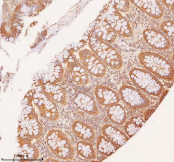 SLK Rabbit Polyclonal Antibody