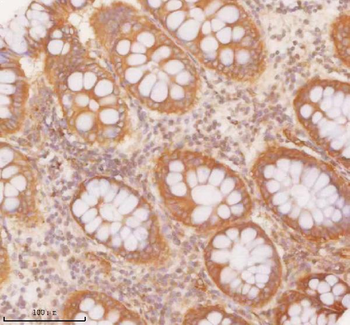 SLK Rabbit Polyclonal Antibody