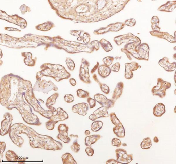 SLK Rabbit Polyclonal Antibody