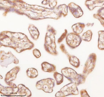 SLK Rabbit Polyclonal Antibody