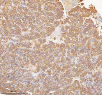 SLK Rabbit Polyclonal Antibody