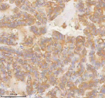 SLK Rabbit Polyclonal Antibody