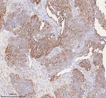SLC6A20 Antibody