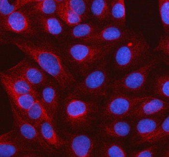 SLC37A3 Rabbit Polyclonal Antibody
