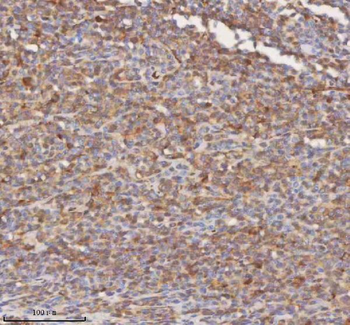 SHKBP1 Rabbit Polyclonal Antibody
