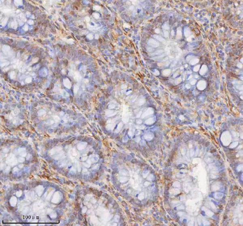 SHKBP1 Rabbit Polyclonal Antibody