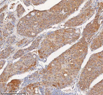 SHKBP1 Rabbit Polyclonal Antibody