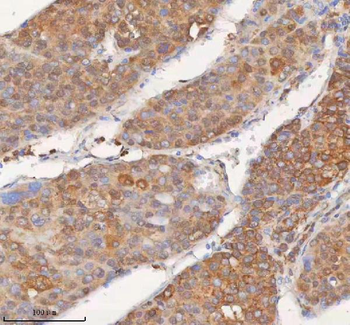 SHKBP1 Rabbit Polyclonal Antibody