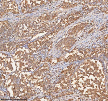 SHKBP1 Rabbit Polyclonal Antibody