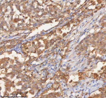 SHKBP1 Rabbit Polyclonal Antibody