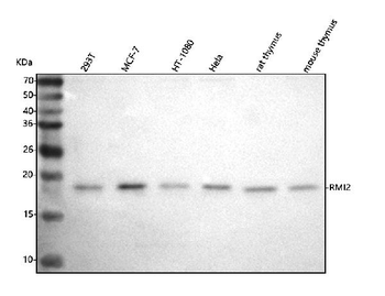 C16orf75/RMI2 Rabbit Polyclonal Antibody
