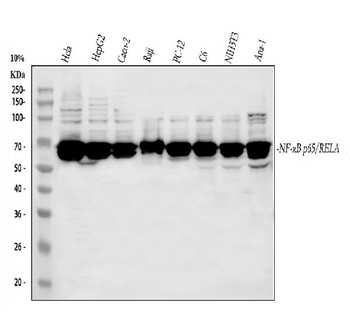 NF-κB p6/RELA Rabbit Polyclonal Antibody