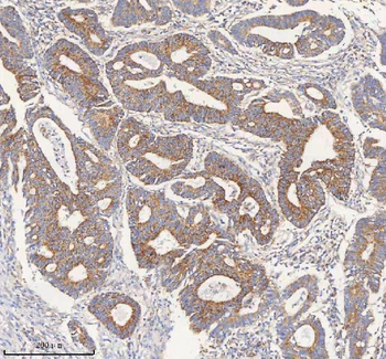 PCCA Rabbit Polyclonal Antibody