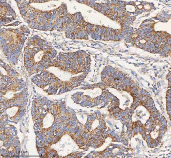PCCA Rabbit Polyclonal Antibody