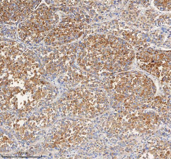PCCA Rabbit Polyclonal Antibody