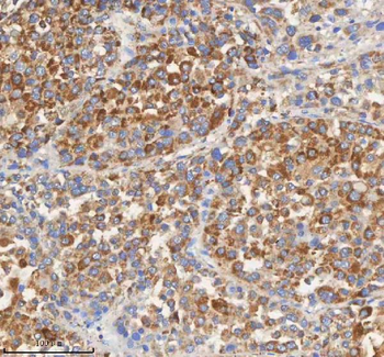 PCCA Rabbit Polyclonal Antibody