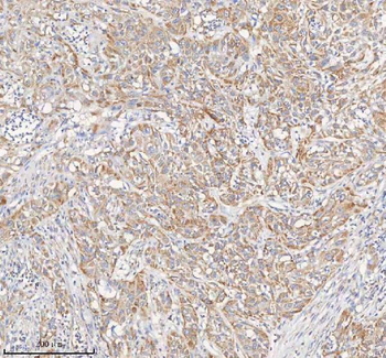 PCCA Rabbit Polyclonal Antibody