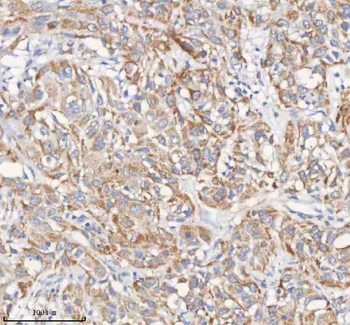 PCCA Rabbit Polyclonal Antibody