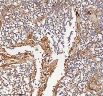 MIPEP Rabbit Polyclonal Antibody