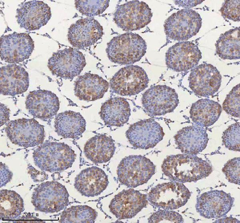 MIPEP Rabbit Polyclonal Antibody