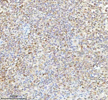 METTL18 Rabbit Polyclonal Antibody