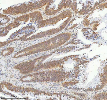 METTL18 Rabbit Polyclonal Antibody