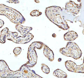 METTL18 Rabbit Polyclonal Antibody