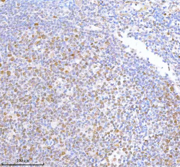 METTL18 Rabbit Polyclonal Antibody