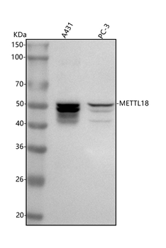 METTL18 Rabbit Polyclonal Antibody