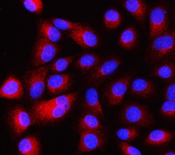 Intersectin 1/ITSN1 Rabbit Polyclonal Antibody